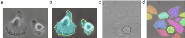 Figure 3 for A State-of-the-art Survey of U-Net in Microscopic Image Analysis: from Simple Usage to Structure Mortification