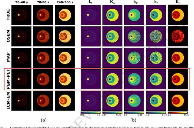 Figure 3 for Probabilistic Graphical Modeling approach to dynamic PET direct parametric map estimation and image reconstruction