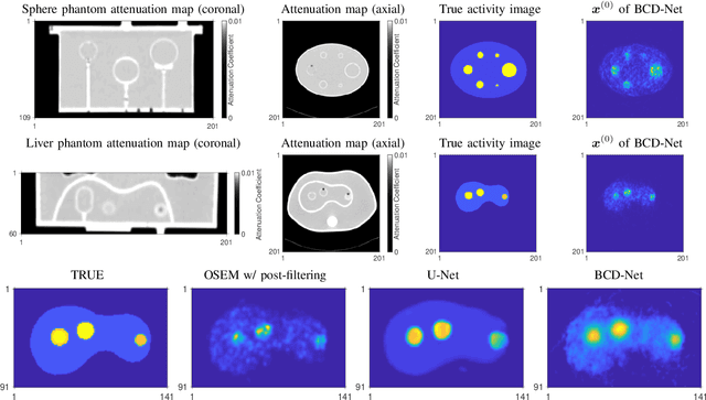 Figure 4 for Improved low-count quantitative PET reconstruction with a variational neural network