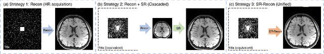 Figure 1 for SRR-Net: A Super-Resolution-Involved Reconstruction Method for High Resolution MR Imaging