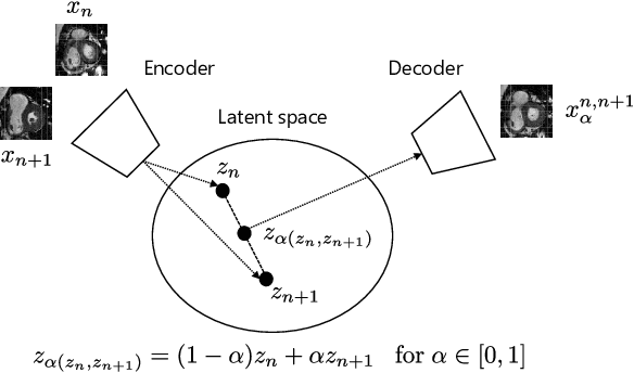 Figure 1 for Unsupervised Super-Resolution: Creating High-Resolution Medical Images from Low-Resolution Anisotropic Examples