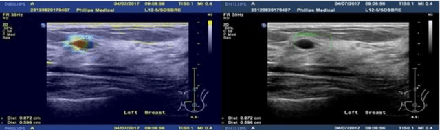 Figure 3 for Knowledge AI: New Medical AI Solution for Medical image Diagnosis