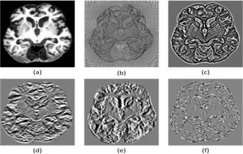 Figure 4 for Knowledge AI: New Medical AI Solution for Medical image Diagnosis