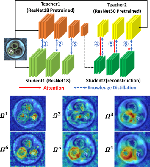 Figure 3 for Reconstructed Student-Teacher and Discriminative Networks for Anomaly Detection