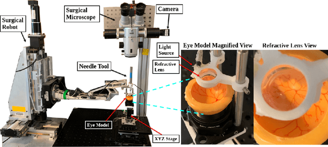 Figure 4 for Towards Autonomous Eye Surgery by Combining Deep Imitation Learning with Optimal Control