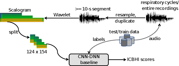 Figure 1 for Inception-Based Network and Multi-Spectrogram Ensemble Applied For Predicting Respiratory Anomalies and Lung Diseases