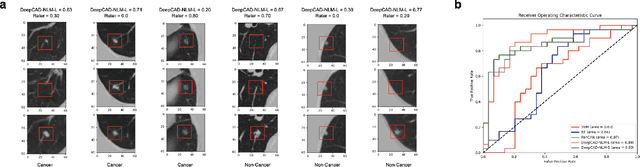 Figure 3 for Enhancing Cancer Prediction in Challenging Screen-Detected Incident Lung Nodules Using Time-Series Deep Learning