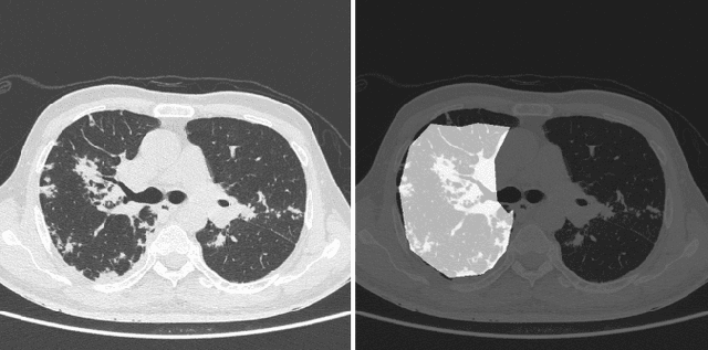 Figure 2 for Automated Detection of COVID-19 from CT Scans Using Convolutional Neural Networks