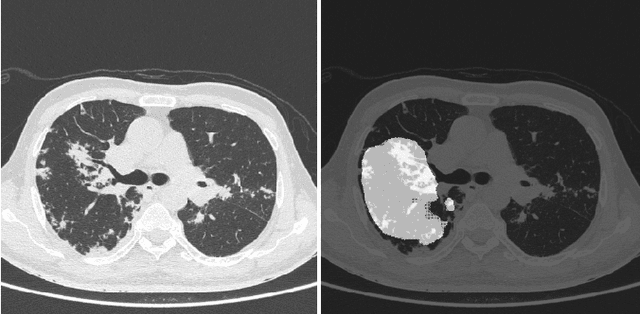 Figure 3 for Automated Detection of COVID-19 from CT Scans Using Convolutional Neural Networks