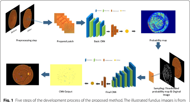 Figure 1 for Microaneurysm Detection in Fundus Images Using a Two-step Convolutional Neural Networks
