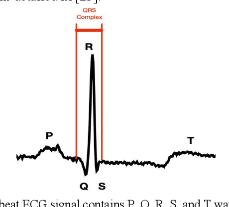 Figure 1 for ECG Heartbeat classification using deep transfer learning with Convolutional Neural Network and STFT technique