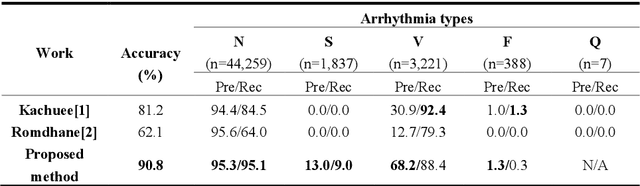 Figure 3 for ECG Heartbeat classification using deep transfer learning with Convolutional Neural Network and STFT technique