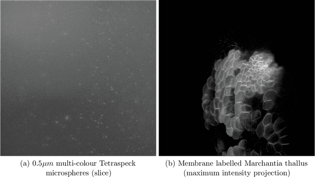 Figure 3 for Image reconstruction in light-sheet microscopy: spatially varying deconvolution and mixed noise