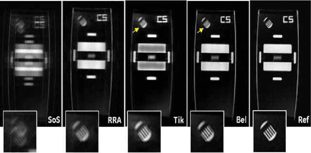 Figure 4 for Motion Estimated-Compensated Reconstruction with Preserved-Features in Free-Breathing Cardiac MRI