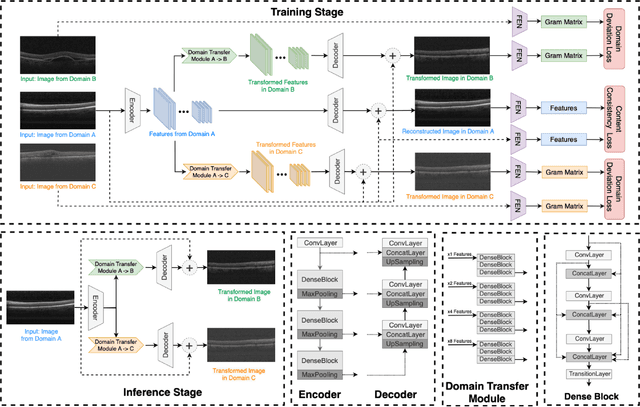 Figure 1 for MDT-Net: Multi-domain Transfer by Perceptual Supervision for Unpaired Images in OCT Scan