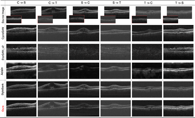 Figure 3 for MDT-Net: Multi-domain Transfer by Perceptual Supervision for Unpaired Images in OCT Scan