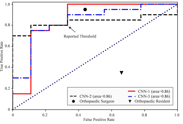 Figure 3 for Improved Diagnosis of Tibiofemoral Cartilage Defects on MRI Images Using Deep Learning