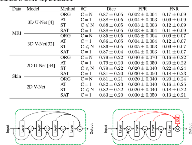 Figure 2 for Select, Attend, and Transfer: Light, Learnable Skip Connections