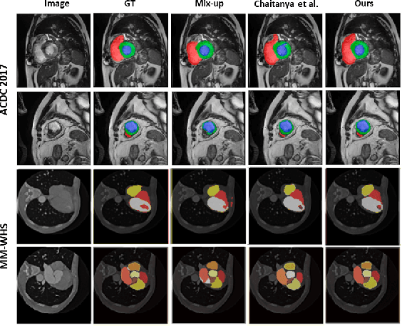 Figure 4 for An Embarrassingly Simple Consistency Regularization Method for Semi-Supervised Medical Image Segmentation
