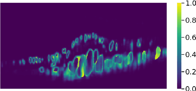 Figure 3 for Segmentation of Macular Edema Datasets with Small Residual 3D U-Net Architectures