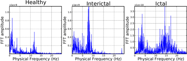 Figure 2 for Automated Epilepsy Diagnosis Using Interictal Scalp EEG