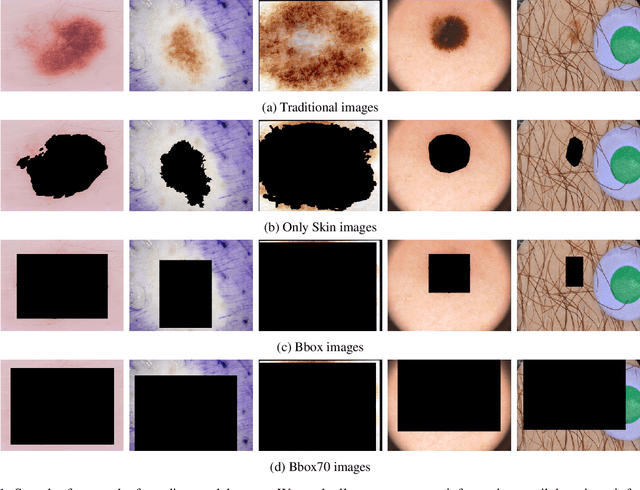 Figure 1 for (De)Constructing Bias on Skin Lesion Datasets