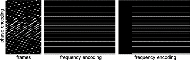 Figure 3 for Free-breathing Cardiovascular MRI Using a Plug-and-Play Method with Learned Denoiser
