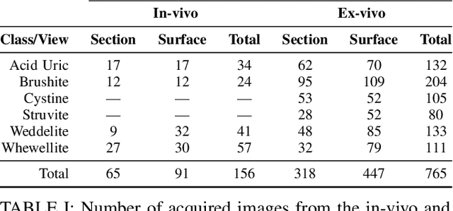 Figure 4 for On the generalization capabilities of FSL methods through domain adaptation: a case study in endoscopic kidney stone image classification