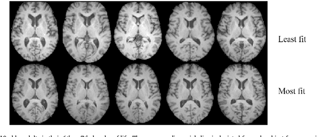 Figure 1 for Discovery and visualization of structural biomarkers from MRI using transport-based morphometry