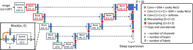 Figure 3 for 3D Segmentation with Fully Trainable Gabor Kernels and Pearson's Correlation Coefficient