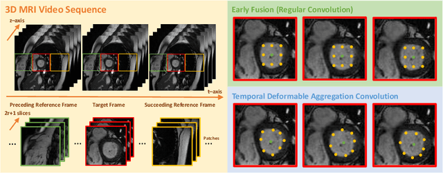 Figure 3 for DeU-Net: Deformable U-Net for 3D Cardiac MRI Video Segmentation