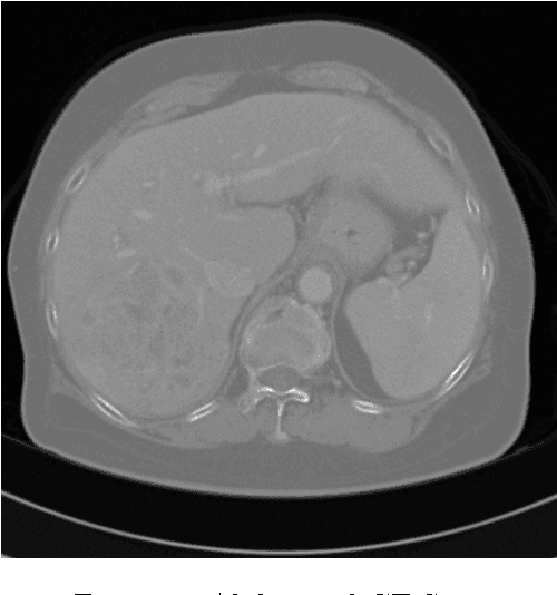 Figure 1 for Classification of Hepatic Lesions using the Matching Metric