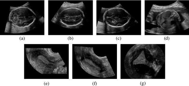 Figure 1 for Agent with Warm Start and Adaptive Dynamic Termination for Plane Localization in 3D Ultrasound