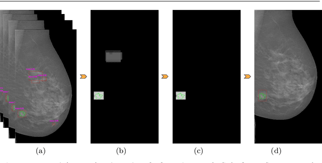 Figure 4 for Two-stage breast mass detection and segmentation system towards automated high-resolution full mammogram analysis