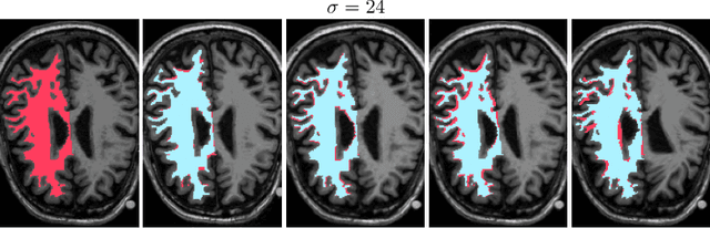 Figure 3 for MoDIR: Motion-Compensated Training for Deep Image Reconstruction without Ground Truth