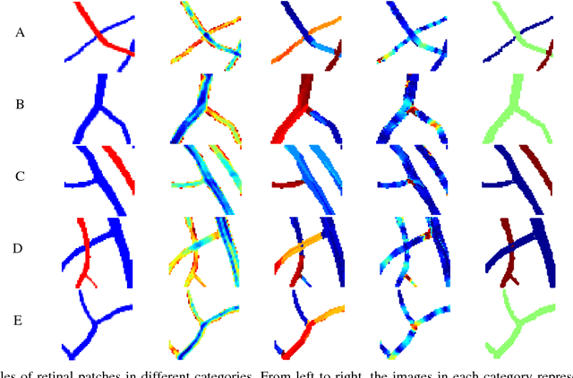 Figure 4 for Curvature Integration in a 5D Kernel for Extracting Vessel Connections in Retinal Images