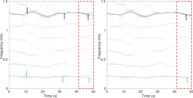 Figure 4 for An Efficient Forecasting Approach to Reduce Boundary Effects in Real-Time Time-Frequency Analysis