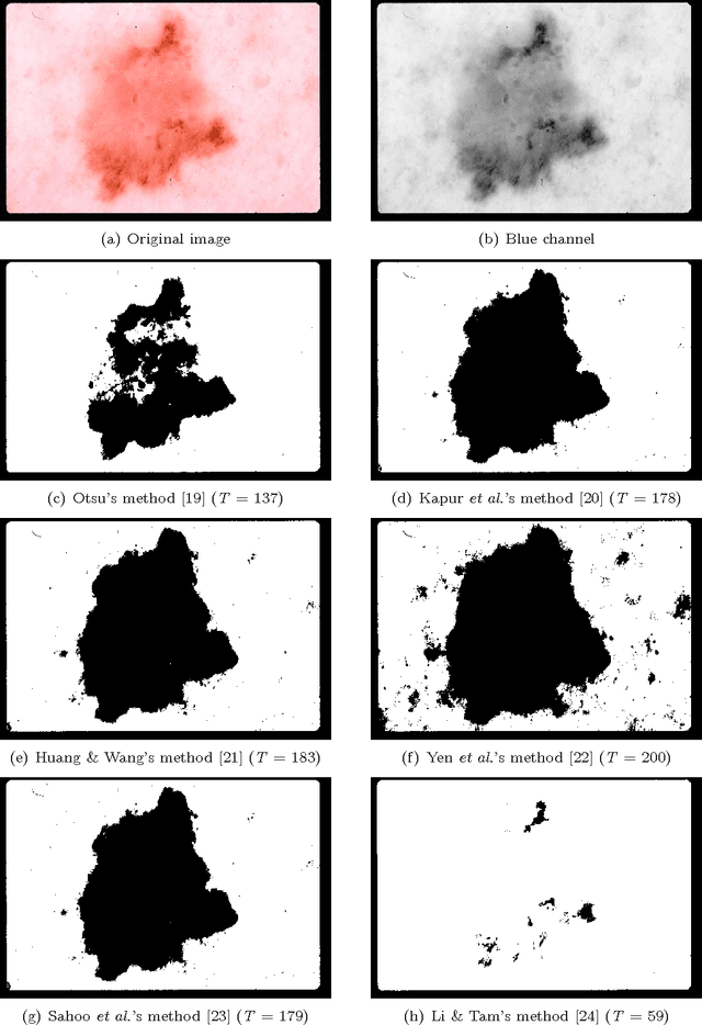 Figure 2 for Approximate Lesion Localization in Dermoscopy Images