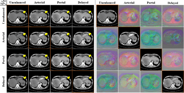 Figure 2 for CycleMorph: Cycle Consistent Unsupervised Deformable Image Registration