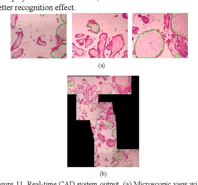 Figure 3 for A Semantic Segmentation Network Based Real-Time Computer-Aided Diagnosis System for Hydatidiform Mole Hydrops Lesion Recognition in Microscopic View