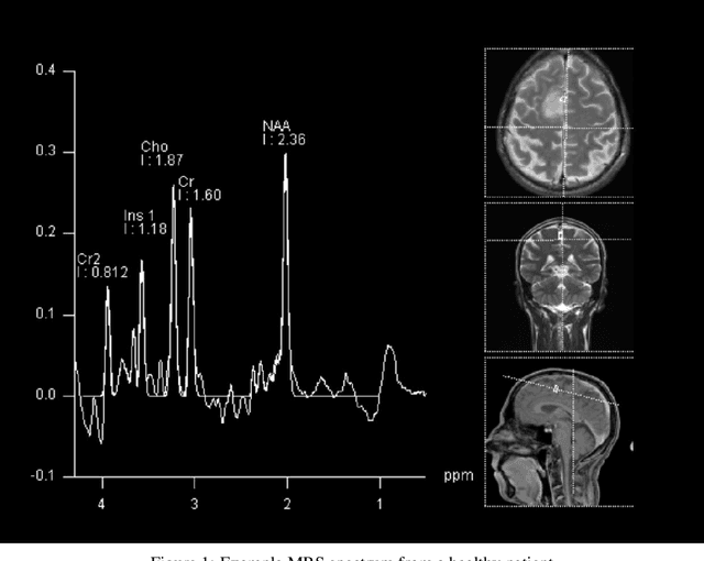 Figure 1 for Human-Expert-Level Brain Tumor Detection Using Deep Learning with Data Distillation and Augmentation