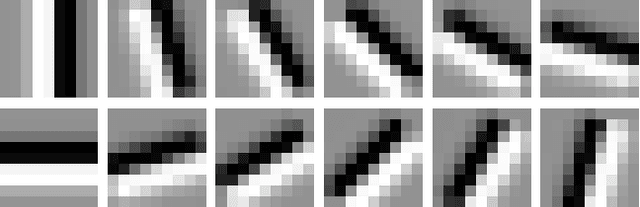 Figure 3 for Blood Vessel Detection using Modified Multiscale MF-FDOG Filters for Diabetic Retinopathy