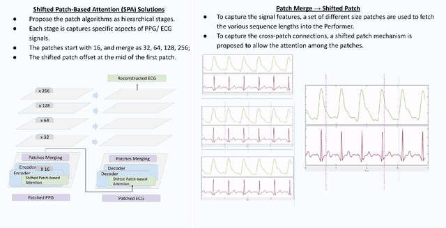 Figure 4 for Performer: A Novel PPG to ECG Reconstruction Transformer For a Digital Biomarker of Cardiovascular Disease Detection