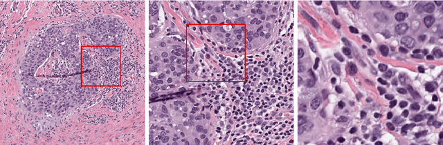 Figure 1 for Transitioning between Convolutional and Fully Connected Layers in Neural Networks
