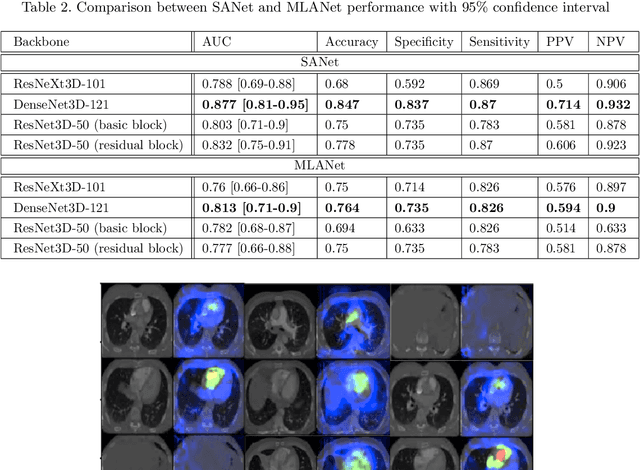 Figure 4 for Weakly Supervised Attention Model for RV StrainClassification from volumetric CTPA Scans