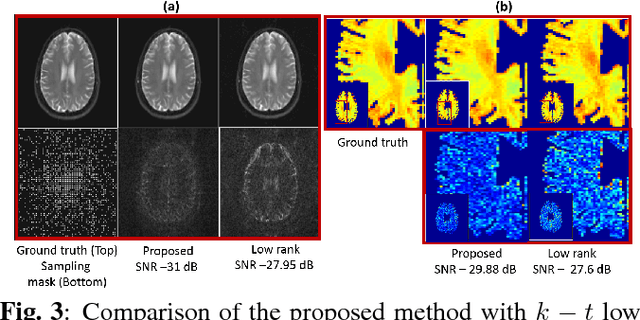 Figure 4 for Novel Structured Low-rank algorithm to recover spatially smooth exponential image time series