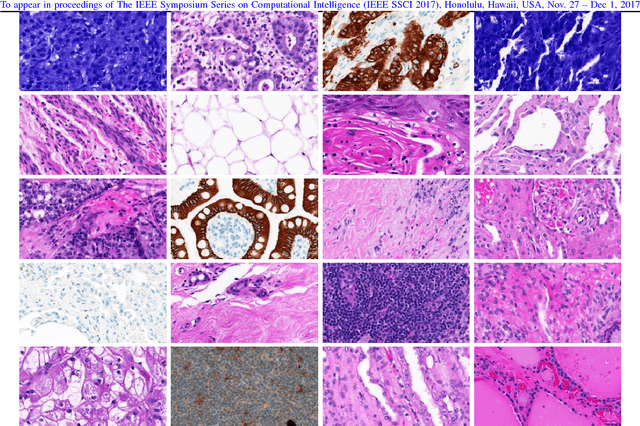 Figure 1 for A Comparative Study of CNN, BoVW and LBP for Classification of Histopathological Images