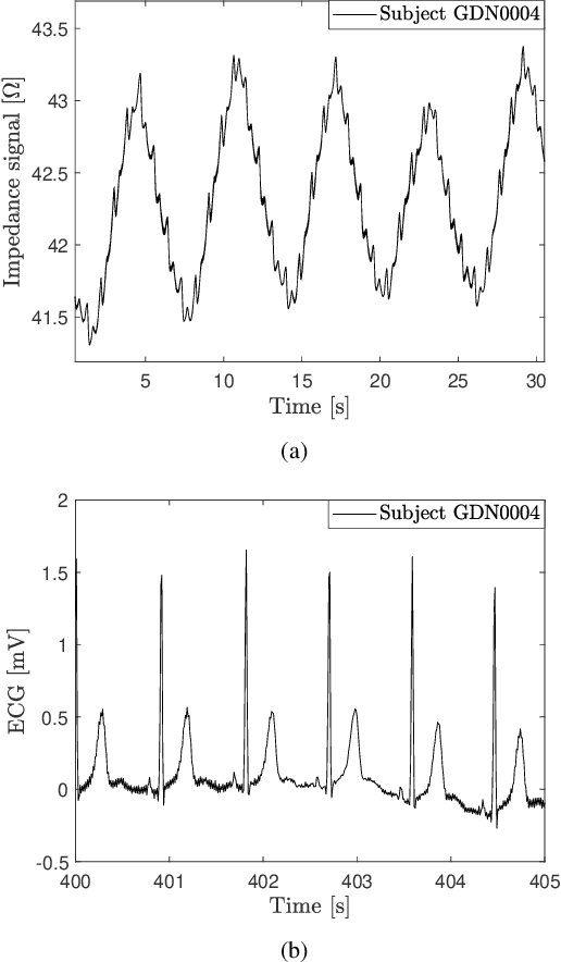 Figure 4 for Sparsity Based Non-Contact Vital Signs Monitoring of Multiple People Via FMCW Radar