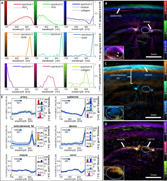 Figure 3 for Spotlight on nerves: Portable multispectral optoacoustic imaging of peripheral nerve vascularization and morphology