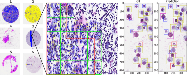 Figure 2 for Learning to be EXACT, Cell Detection for Asthma on Partially Annotated Whole Slide Images